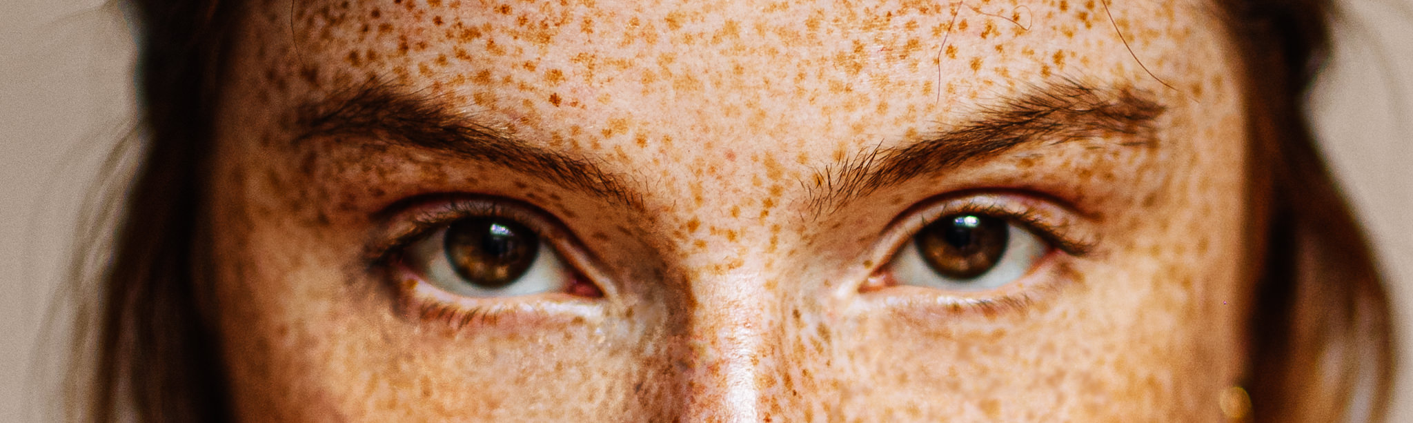 Portraits-Amsterdam-redhead-dutch-freckles-photography-photographer-closeup-eyes